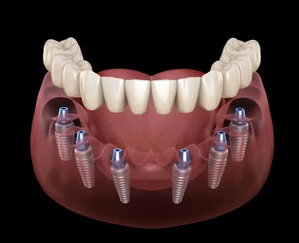 Grand dental Hospital