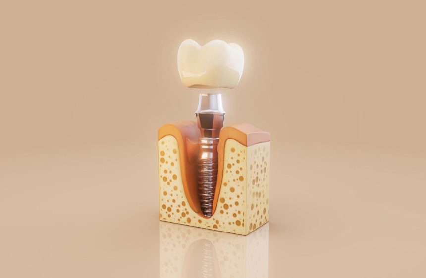 Grand-Dnetal-Hospital-Dnetal-Implants-In-Albania